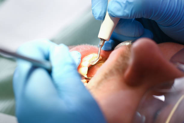 Best 24-Hour Emergency Dental Care in Ruckersville, VA