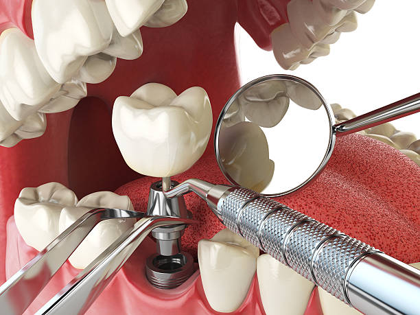 Best Emergency Care for Gum Disease in Ruckersville, VA